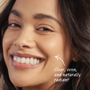 Close-up of a woman's face with text indicating clear, even, and naturally radiant skin.